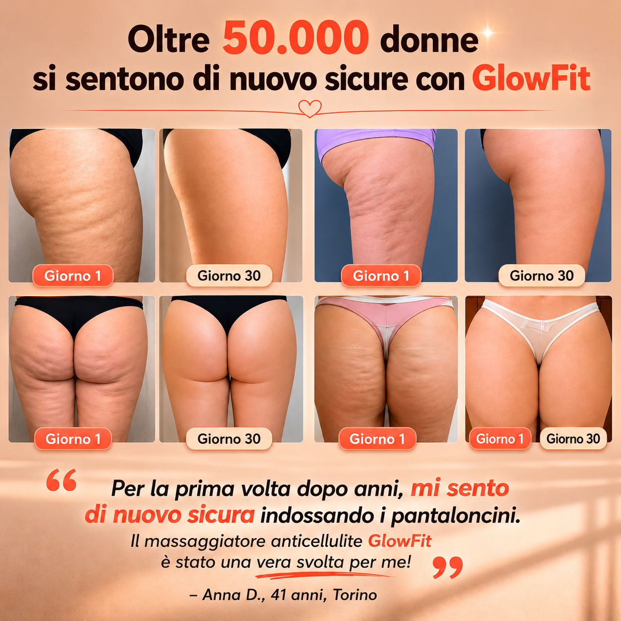 57.000+ donne hanno scelto ELA · Garanzia 90 giorni